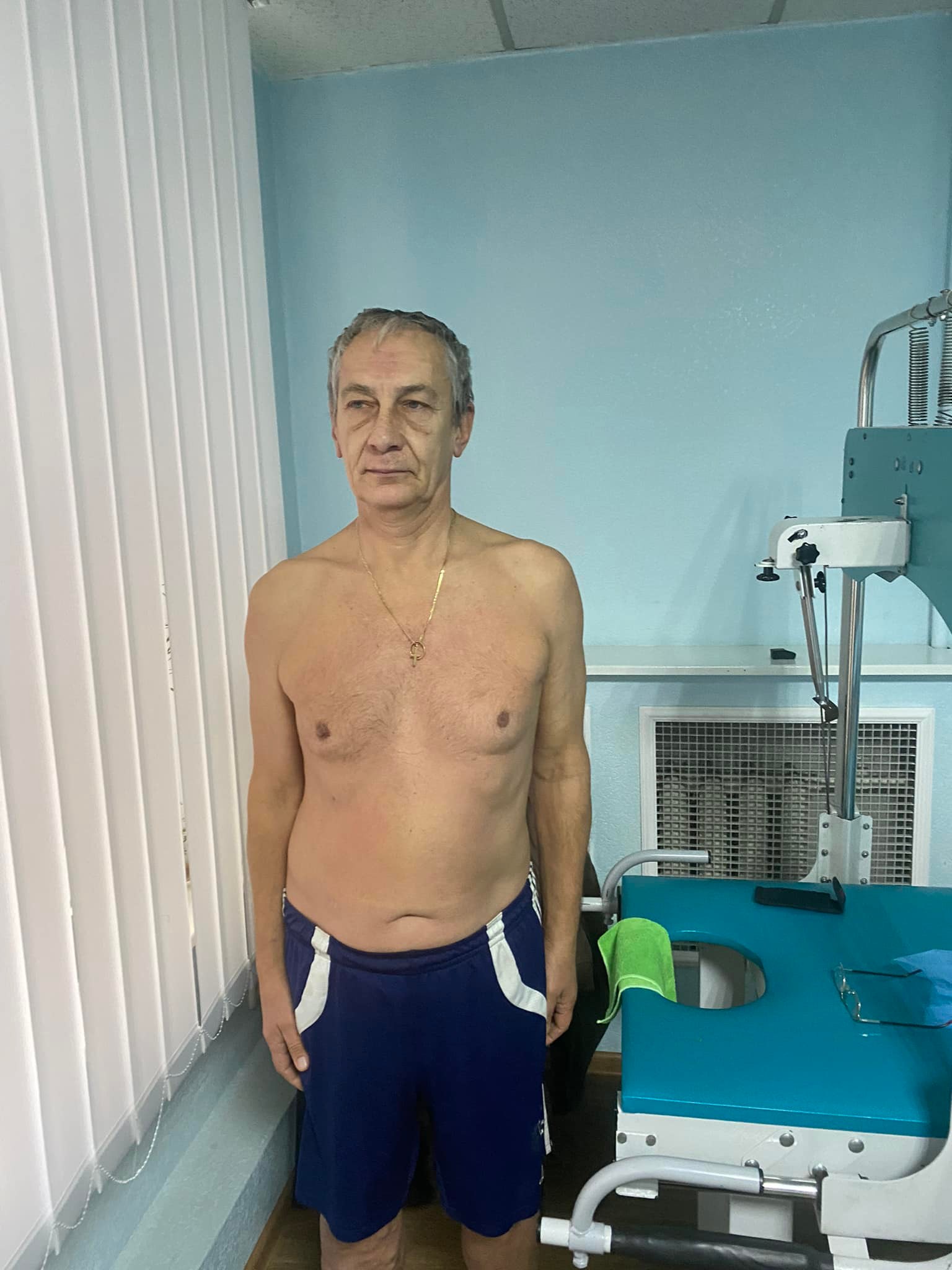 ПОСЛЕ