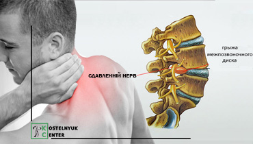 <span>Заболевания</span>Грыжа шейного отдела